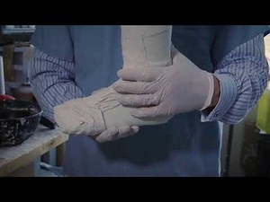 How A Custom AFO Is Made Part 2: Preparation and Pouring Plaster