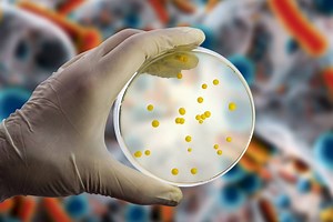 Antibiótico capaz de matar superbactéria é descoberto com ajuda de IA