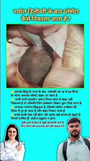 How is the placenta removed after a normal delivery? Placenta removal tips || #viral #placenta