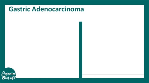 致癌微生物：病毒、细菌和寄生虫如何可能引发癌症（USMLE Step 1） - Animated biology With arpan