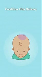 What Is a Vacuum‑Assisted Birth?