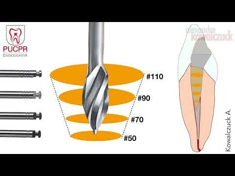Técnica de Preparo Manual do Canal Radicular - Endodontia PUCPR