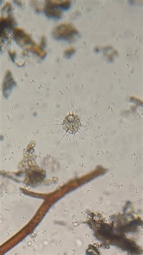 Heliozoan (Sun Animalcule) surrounded by Spirillum Bacteria