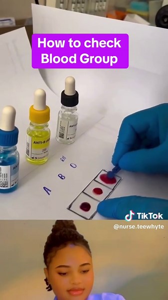 How to Check Blood Group Easily: A Step-by-Step Guide