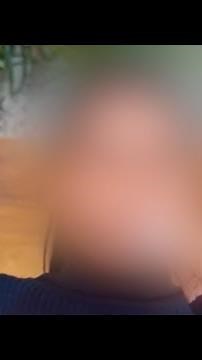 Inspiring MTF Transformation | Penile Inversion Type B by Dr. Narendra Kaushik