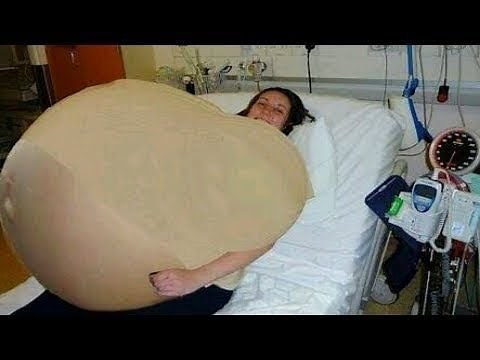 Doctors examined her abdomen and experienced a huge surprise!