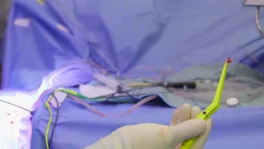 Teen sings her way through brain surgery