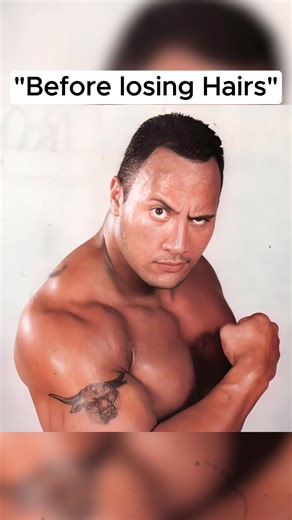 Hollywood Actors Before Losing Their Hairs Part-1