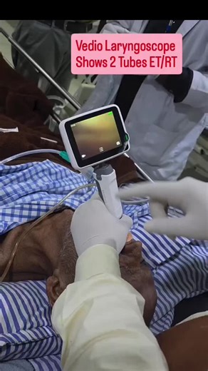 Video laryngoscope #medicalstudent❤️💉💊 #unfreezemyaccoun😭😭😭💔💔💔 #tiktokindia #doctorsoftiktok #heart
