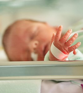 Polydactyly In Babies: Causes, Types & Treatment Explained