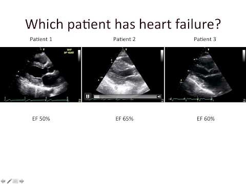 Maan Jokhadar: Diastolic Dysfunction and Diastolic Heart Failure