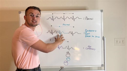 EKG Series: Compensatory and Non-Compensatory Pauses | Georgios Zarifis