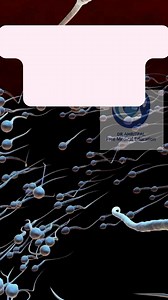 Absence of Sperm formation ? Free medical education | Free medical education