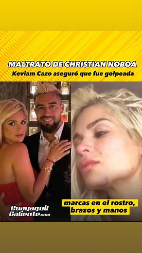 Keviam Cazo: Modelo Acusa Físicamente a Christian Noboa en Rusia