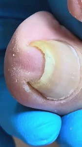 This toenail moment broke the internet CVC0 Beautiful moments of care and relaxation through a gentle pedicure experience. Simple, clean, and satisfying. 🌿✨ Disclaimer: This video is for educational and relaxation purposes only. All content belongs to the respective owners, no copyright infringement is intended. | FC Studio