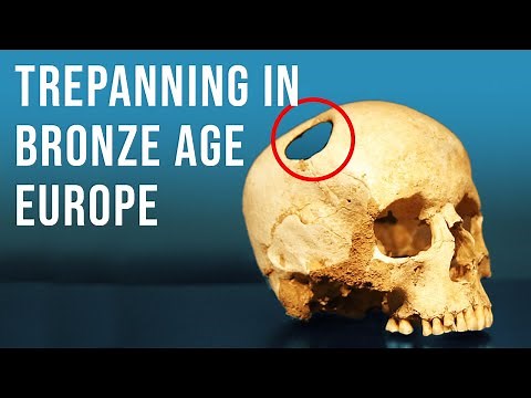 Incredible Prehistoric European Brain Surgery