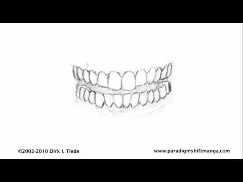 Werewolf Front Teeth Transformation