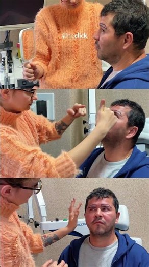 Hair Transplantation