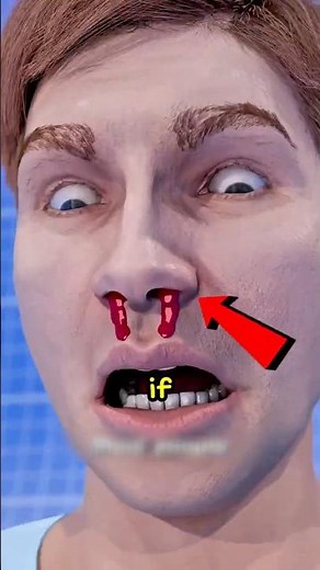 How To Stop A Nose Bleed