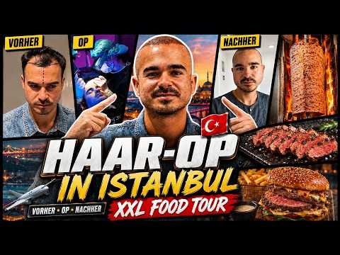 Meine HAARTRANSPLANTATION in Istanbul 🇹🇷 + XXL FOOD TOUR 🥙
