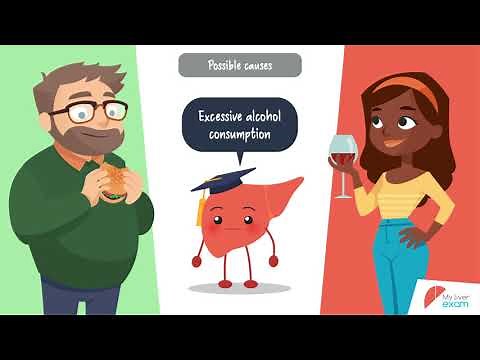 What is liver steatosis?