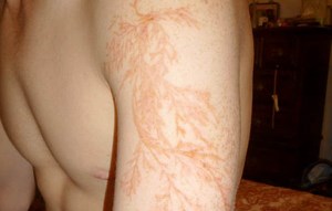 Lichtenberg Figures: The Fractal Patterns of Lightning Strike Scars