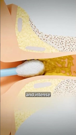 Why Using Q-Tips Feels So Good 😬 Surgeon Reacts