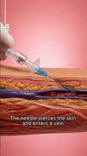How an IV Works