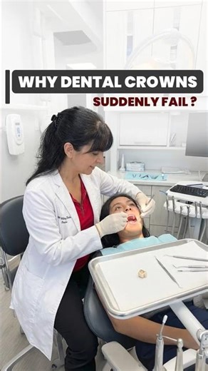 Why Dental Crowns Fail (And How to Make Them Last Longer)