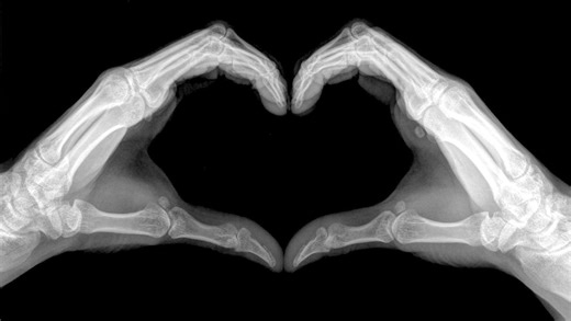 Nutrition for Today: How can I build stronger bones? Nutrition is essential