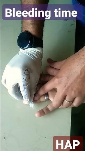 Determination of bleeding time (Procedure Duke's method) #pharmacy #dpharma #bpharma #hap