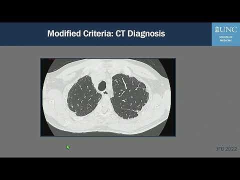 Diagnosis of UIP/IPF on CT: ATS and Fleischner Modifications Criteria (and Considerations)