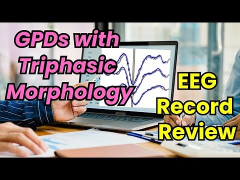 EEG Record Review: GPDs with Triphasic Morphology.