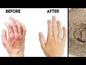 What Is BENTONITE CLAY | TOP 10 BENEFITS & HOW TO USE BENTONITE CLAY