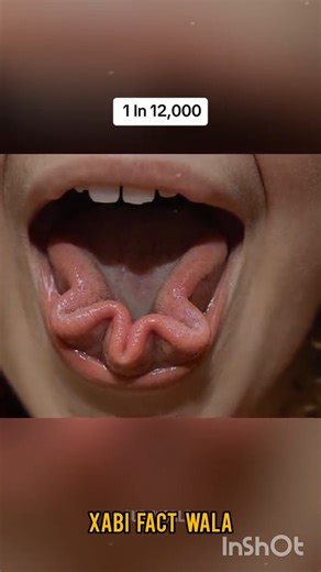 The Rarest Humans Genetic in World😳😲🌍😱 #facts #amzingfacts #viralfacts #shorts #amzingfacts