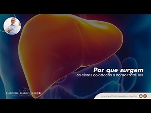 Choledochal cyst: why it occurs and how to treat it | Prof. Dr. Luiz Carneiro CRM 22.761