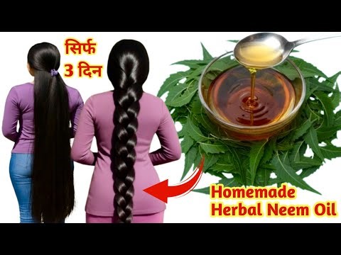सिर्फ 7 दिन में बाल 20x तेजी से बढ़ेंगे बस ये तेल लगा लो🤩/Diy Oil for superfast thick black Hairgrow