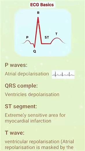 #ECG ECG Basics!