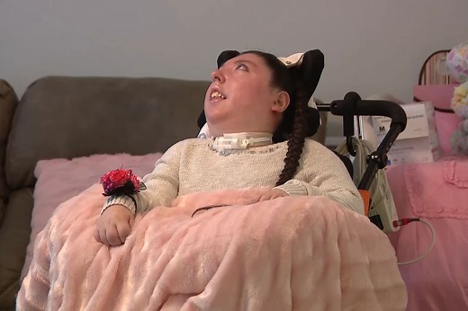 Woman Born Without a Brain Turns 20 After Doctors Believed She Wouldn't Live Past 4 Years Old: 'She's a Fighter'