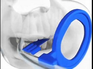 Vertical Bitewing Sensor Placement