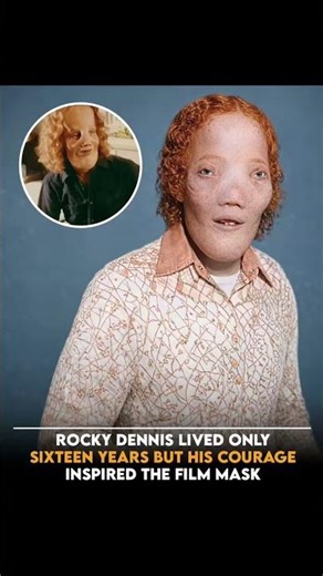 They told his mother he wouldn’t see, hear, or live past seven. Rocky Dennis proved them all wrong.
