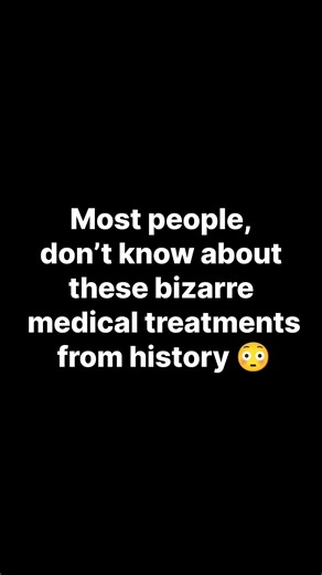 4 Bizarre Medical Treatments From History 😳|#shorts