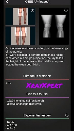 Knee Ap/lat position of x ray #anatomy #medicalimaging #biology #medical #radiologist #vranatomy