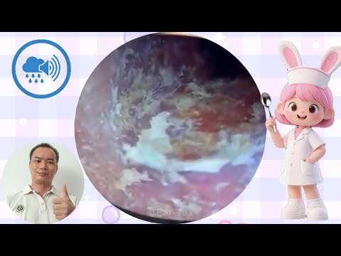 ASMR Ear Cleaning #027–Rain-Blurred Molt Unbinding |Rain Sounds |relax |No Talking【Ear Tax】