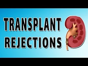 Kidney Transplants