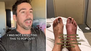 Man speaks on experience after surviving stepping on stonefish