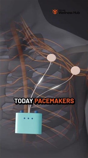 ⚡ How Pacemakers Keep Hearts Beating | Life-Saving Invention Explained