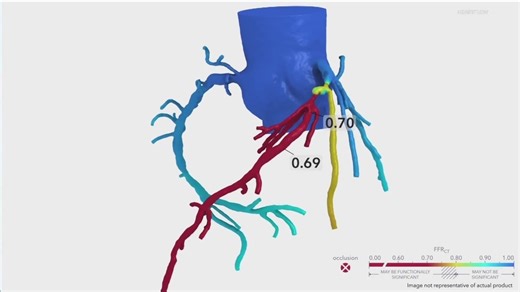 New study aims to evaluate heart disease risks among former NFL players
