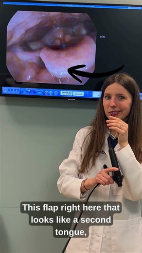 Anatomy of the voice box with laryngoscopy - Inside Look