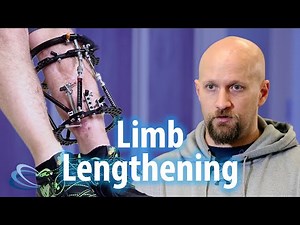 Kellen Smith's Limb Lengthening Patient Journey